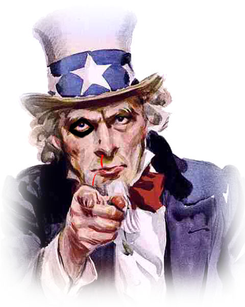Uncle Sam Black-Eye