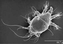 nosema ceranae