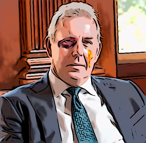 blackeyed diplomat with egg on his face