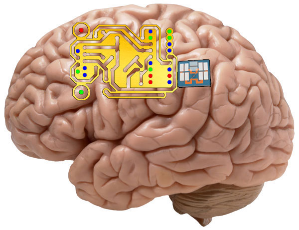 Neural Implants
