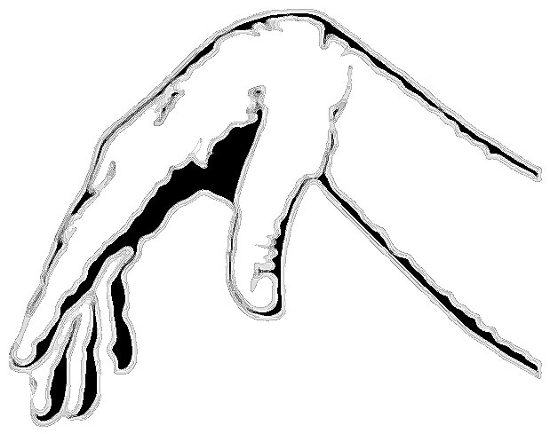 limp wrist