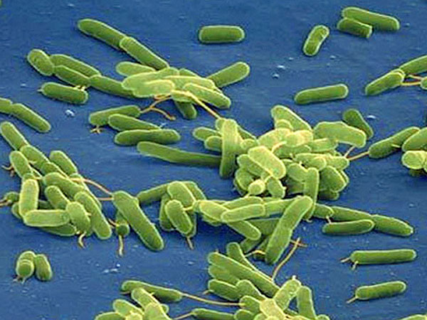 vibrio vulnificus