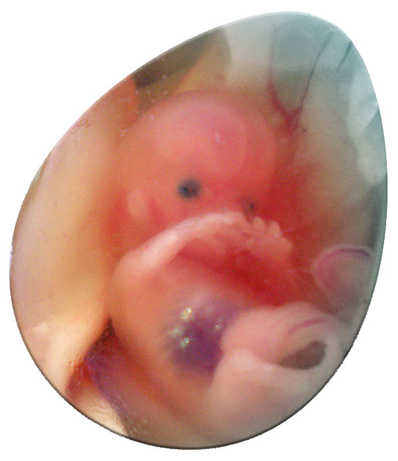 aborted foetus 10 weeks