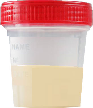 drug pee test