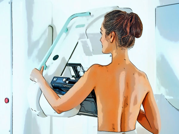 mammography